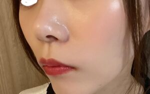 スターオブザカラー クリームファンデーション,6時間後,小鼻周り